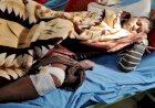 कुत्ते के हमले से युवक गंभीर घायल
