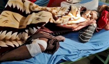 कुत्ते के हमले से युवक गंभीर घायल