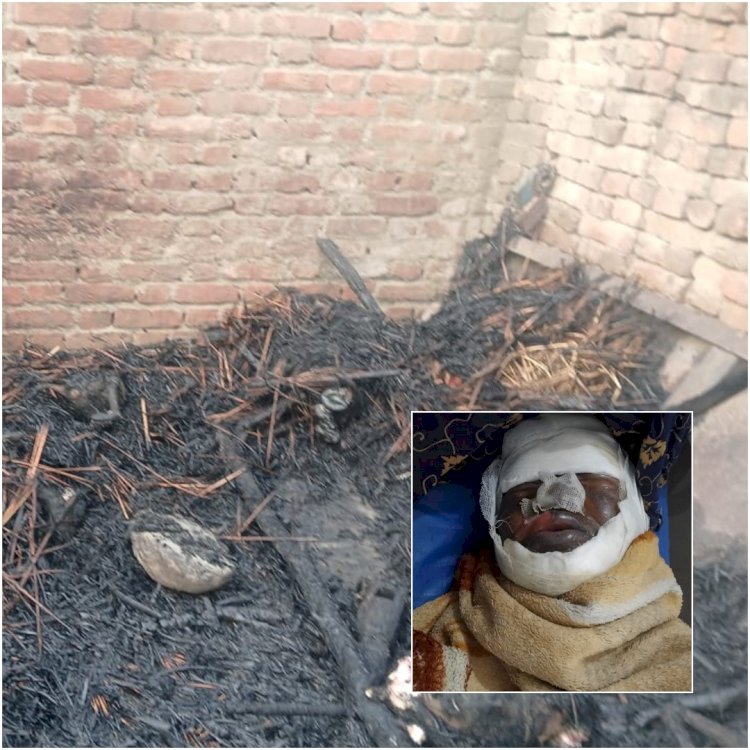 छप्परनुमा पशुशाला में लगी भीषण आग, सात बकरियों की जलकर मौत, महिला गंभीर रूप से झुलसी