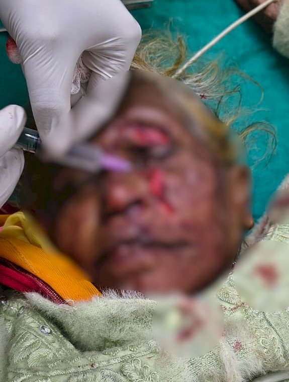 ई-रिक्शा पलटा, महिला गंभीर