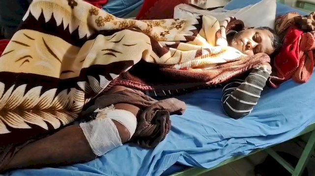 कुत्ते के हमले से युवक गंभीर घायल